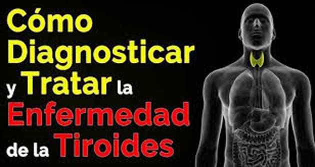 bromo_diagnostico El Bromo inhibe la actividad del yodo en la glándula tiroides
