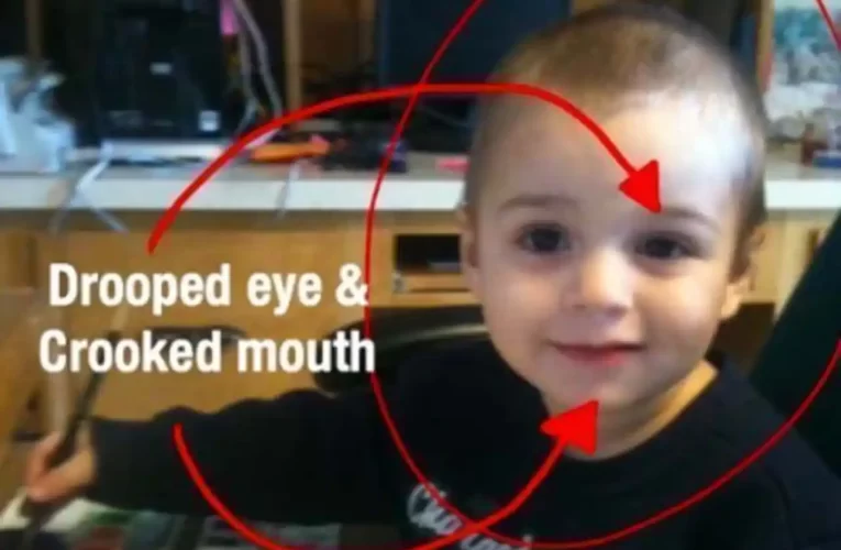 Detectar en la estética facial los síntomas del daño de las vacunas en niños y adultos