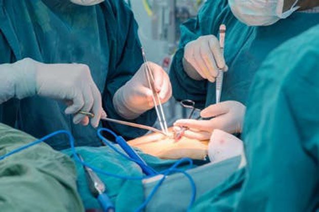 donantes_consentimiento Donantes de Órganos: Inyectan un paralizador si el cuerpo se retuerce