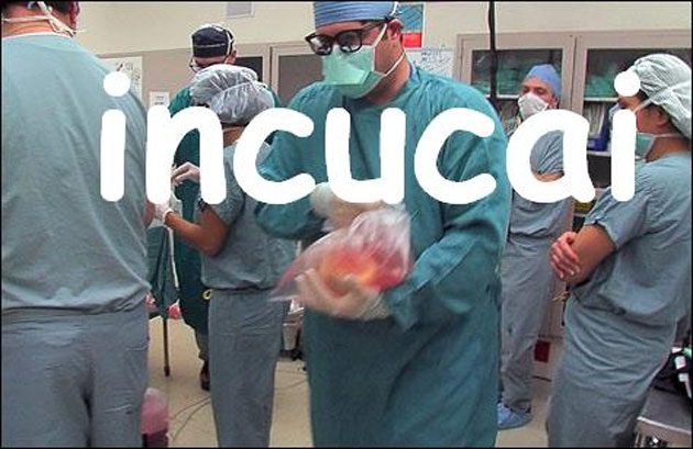 donantes_incucai Donantes de Órganos: Inyectan un paralizador si el cuerpo se retuerce