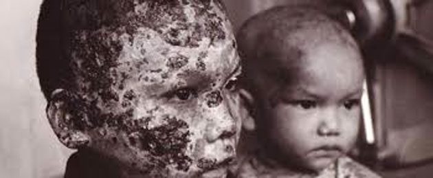 Orbes Argentina – Riesgos de Estados Unidos Desarrolla Arma Extingue - Imagen 1