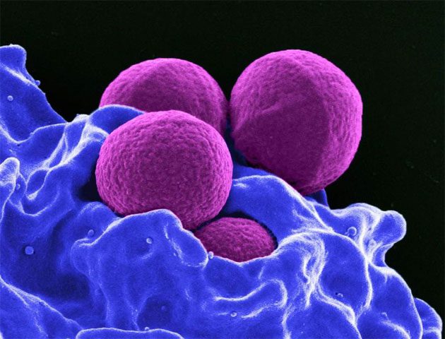 india_superbacteria Venden antibióticos experimentales en la India