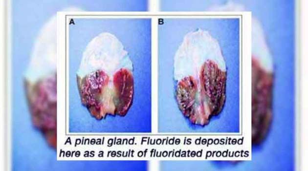 pineal1 El consumo de flúor está asociado con la rápida calcificación de la glándula pineal en el cerebro