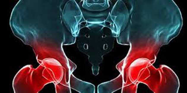 implantes_cadera Los metales tóxicos en los implantes de cadera causan Alzheimer