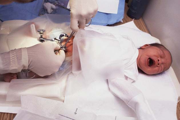 La circuncisión aumenta drásticamente el riesgo de muerte súbita
