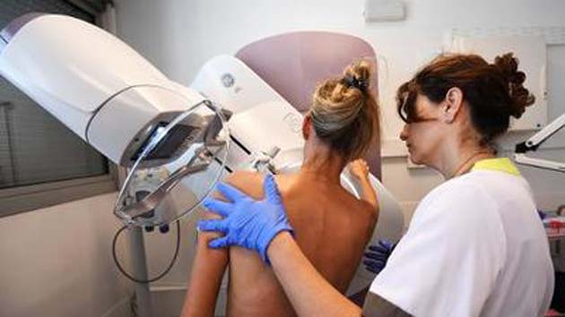 Cancer de mama: 1 mamografía, obsoleta para detectar cancer