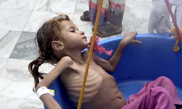hambruna Los restos de un minibús destrozado dejó a otros 20 heridos en Yemen