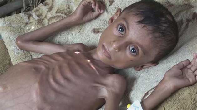 hambruna_borde Los restos de un minibús destrozado dejó a otros 20 heridos en Yemen