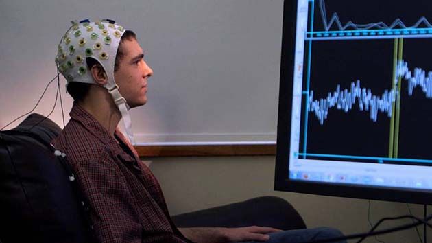 Neuralink: quiere insertar implantes con capacidad Bluetooth en su cerebro