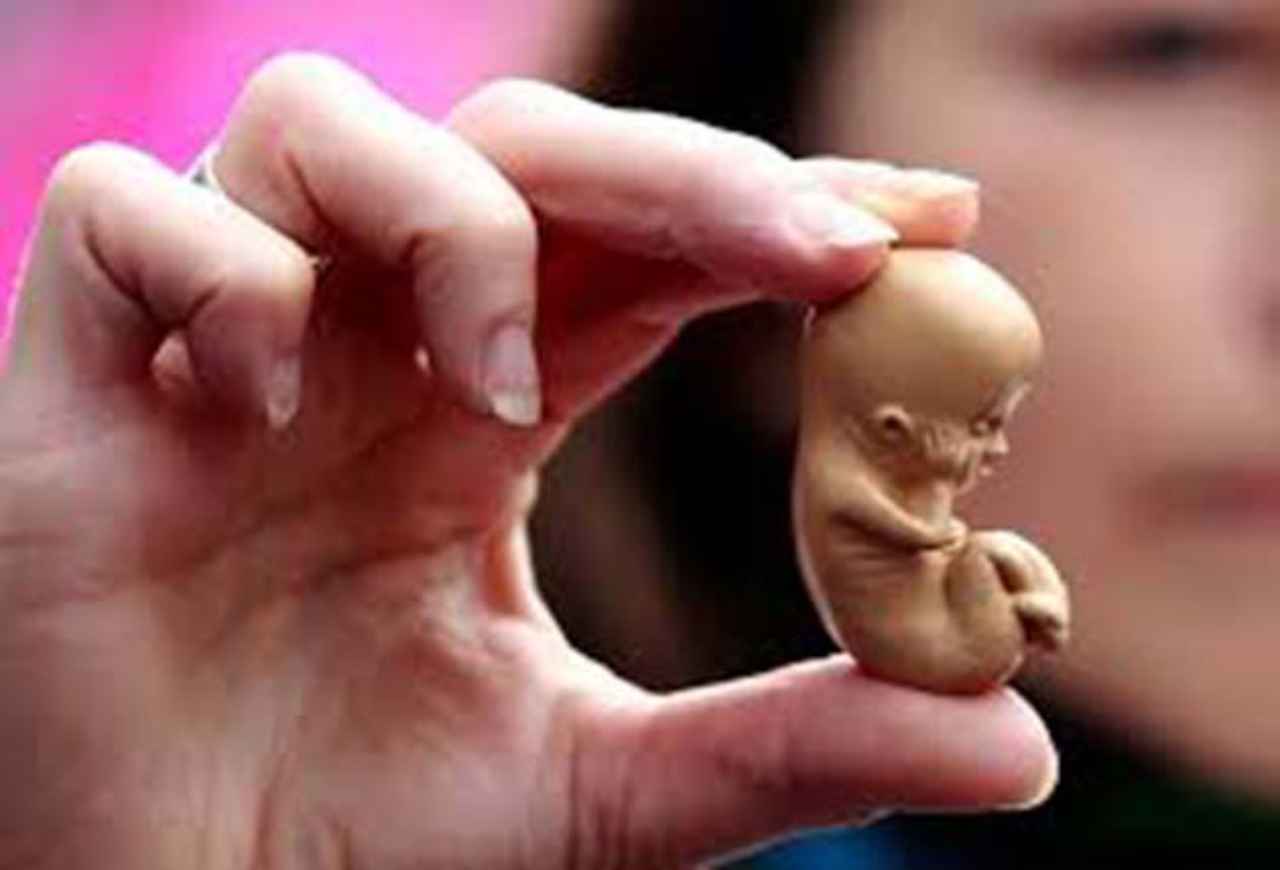 interrupcion-voluntaria-del-embarazo-humanos - 2020-01-05 - Aborto Muerte 1