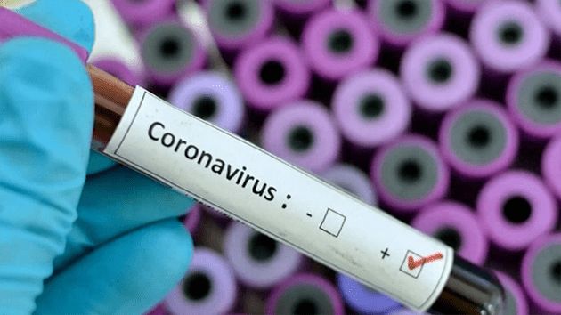Coronavirus: su vacuna está lista para pruebas en animales