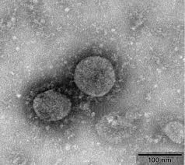 00  Nuevo virus: $4.500 para infectarse con coronavirus  00
