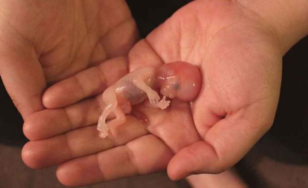aborto-la-oms-lo-declara-servicio-esencial - 2020-04-06 - Aborto Manos 1