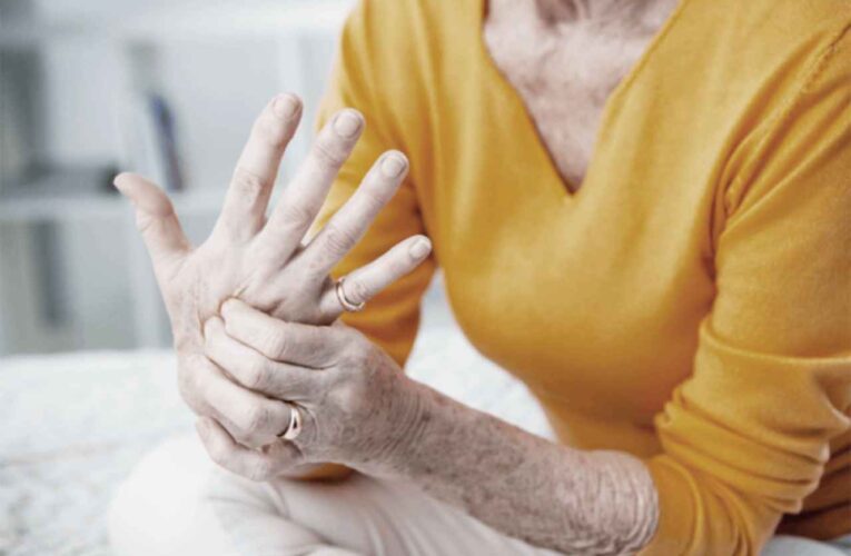 Tratamiento para la artritis: alivie el dolor en las articulaciones