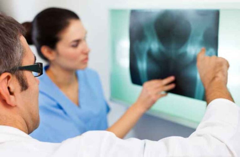 Una mayor ingesta de suplemento de selenio puede reducir el riesgo de osteoporosis