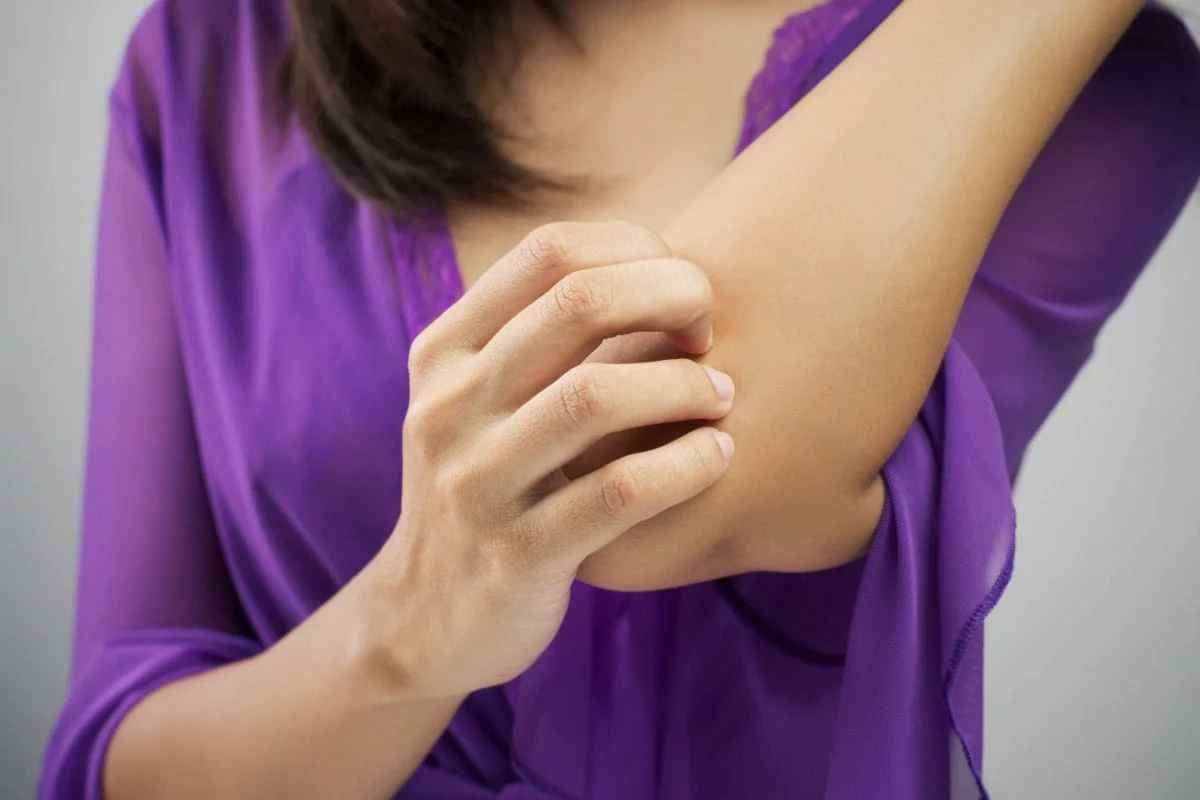 eczema-eliminar-ciertos-alimentos-de-la-dieta - 2022-09-03 - Eczema Rasca