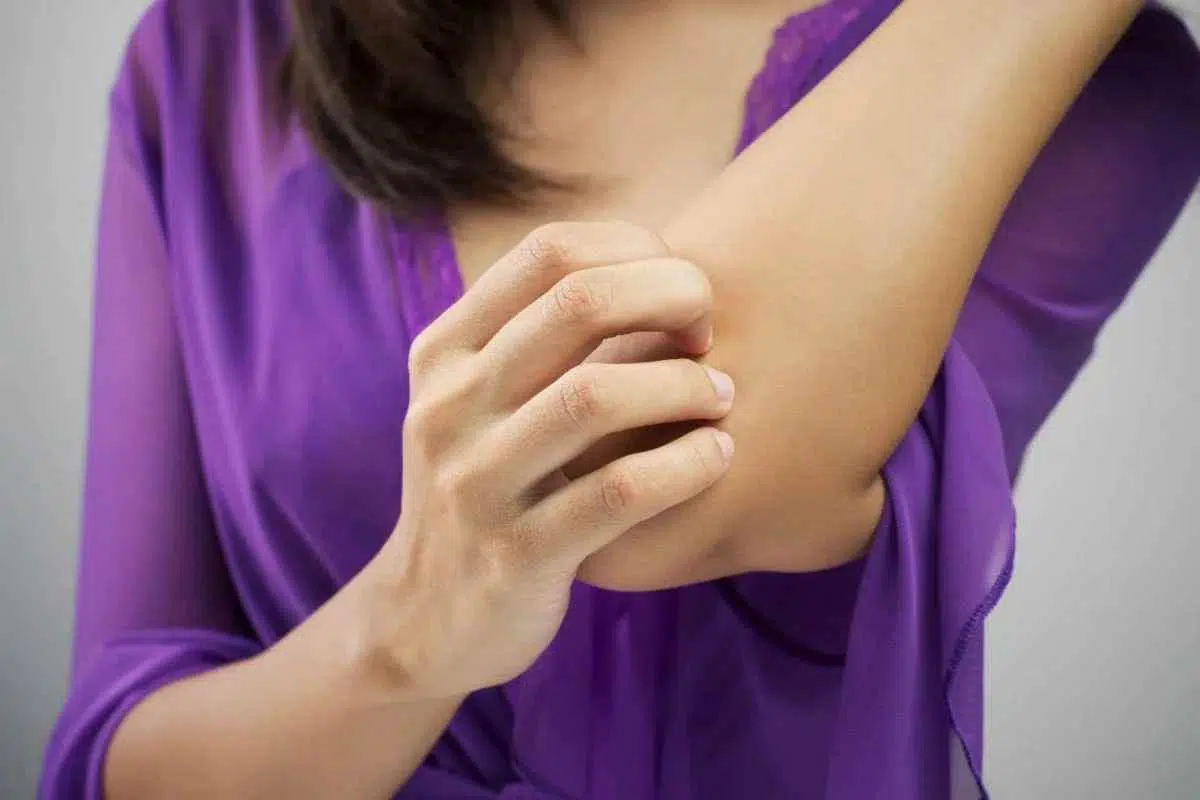 eczema-eliminar-ciertos-alimentos-de-la-dieta - 2022-09-03 - Eczema Rasca