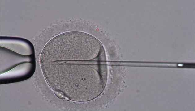 semen_calidad La mitad de los hombres tendrán un recuento de espermatozoides de CERO para 2050