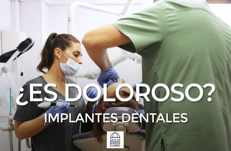 Implante Dental: Todo lo que Necesitas Saber para Recuperar Tu Sonrisa