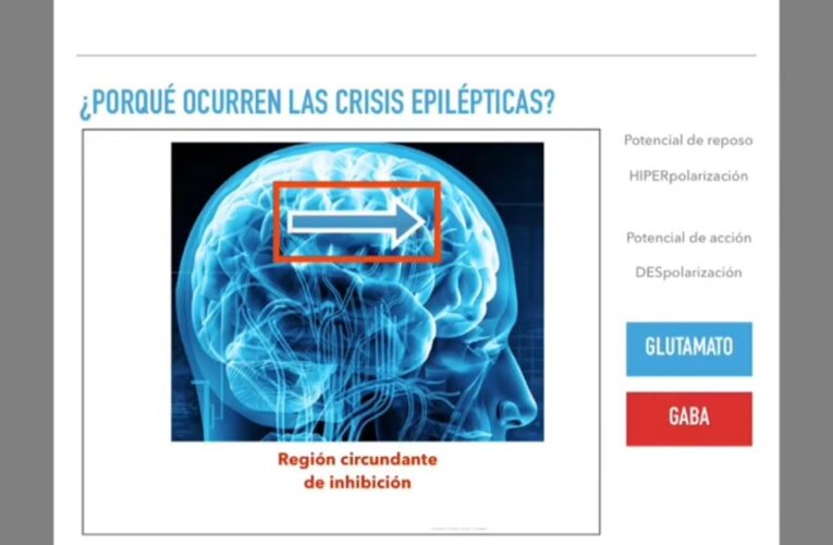 Epilepsia: Síntomas, Diagnóstico y Tratamientos Efectivos para Mejorar tu Calidad de Vida
