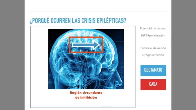 epilepsia-sintomas-diagnostico-y-tratamientos - 2024-07-08 - Epilepsia