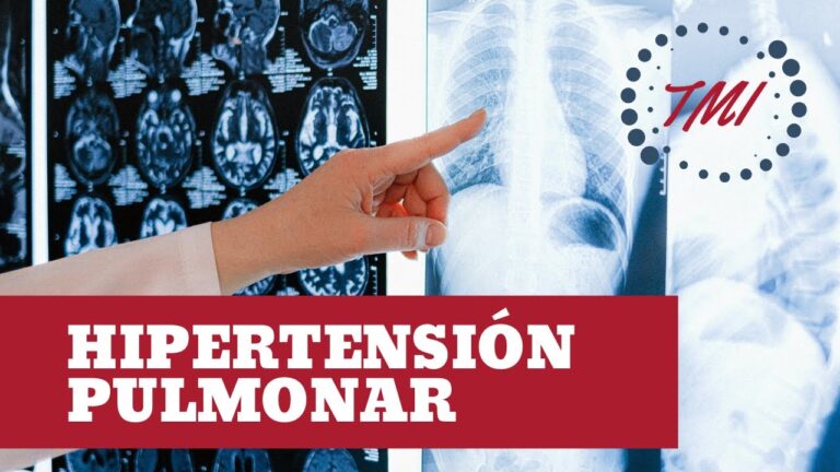 hipertension-pulmonar-sintomas-y-tratamientos - 2024-12-30 - Hipertension Pulmonar