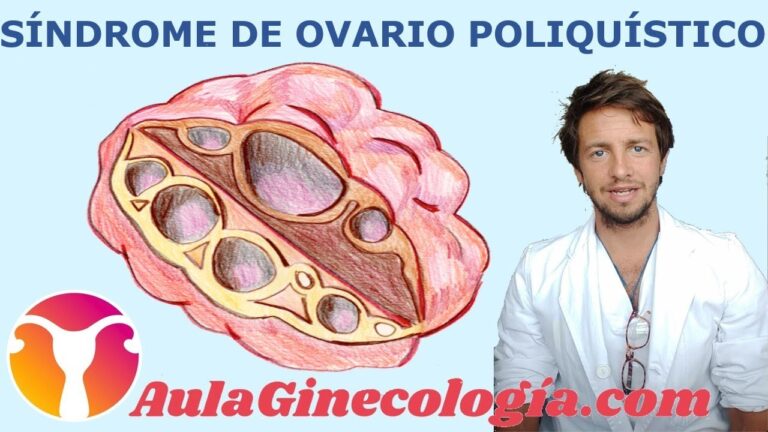 ovario-poliquistico-sintomas-y-tratamientos - 2024-11-11 - Ovario Poliquistico