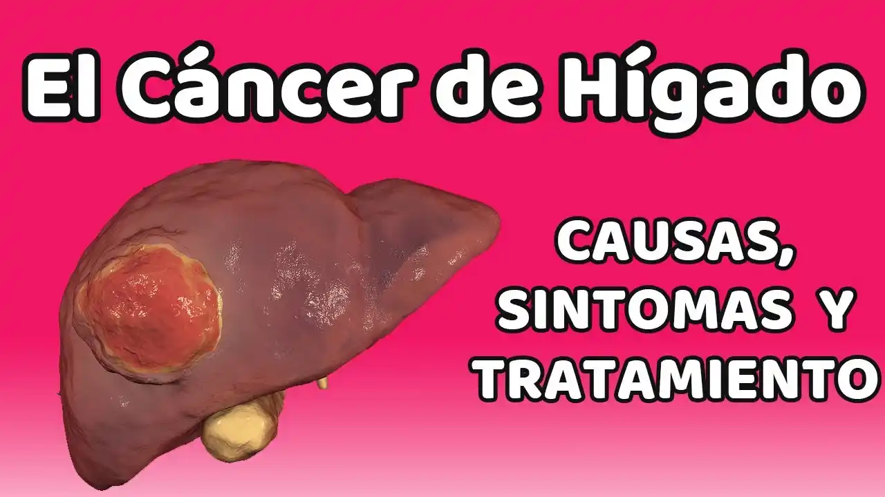 cancer-hepatico-causas-sintomas-y-tratamientos - 2024-12-15 - Causas 1
