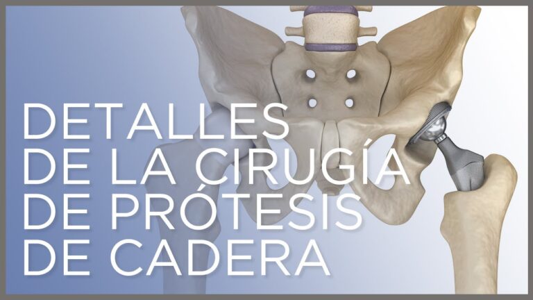 protesis-de-cadera-tipos-y-recuperacion - 2025-01-27 - Protesis De Cadera