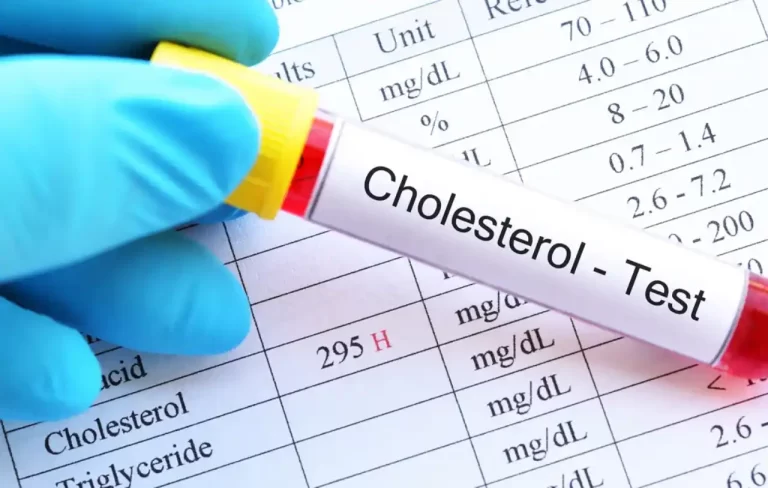 colesterol-hdl-beneficios-y-niveles-saludables - 2025-01-11 - Test