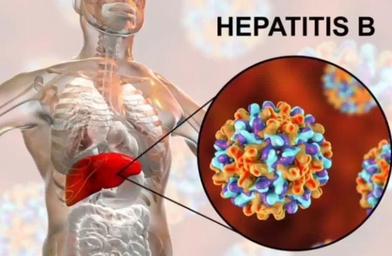 Hepatitis B: Síntomas, Tratamientos y Prevención