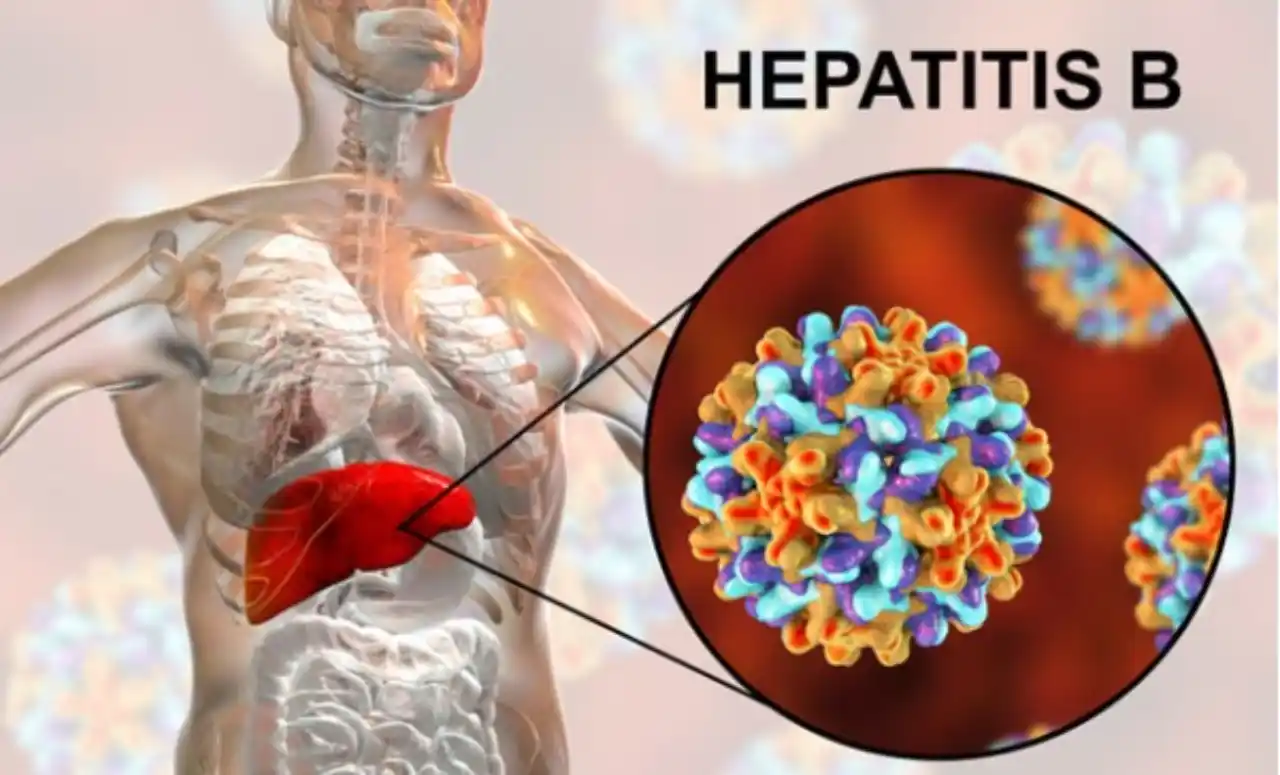 Hepatitis B: Síntomas, Tratamientos y Prevención 1 Orbes Argentina centro -